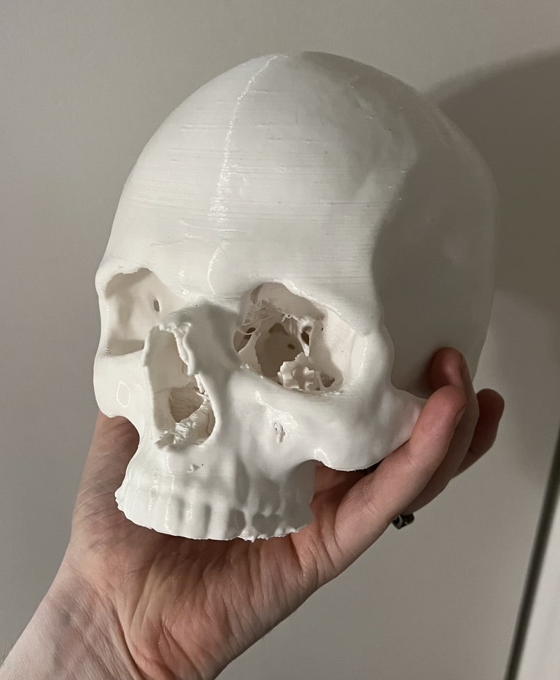 3D Printed version of my own skull